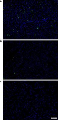 Infection of Fungi and Bacteria in Brain Tissue From Elderly Persons and Patients With Alzheimer’s Disease